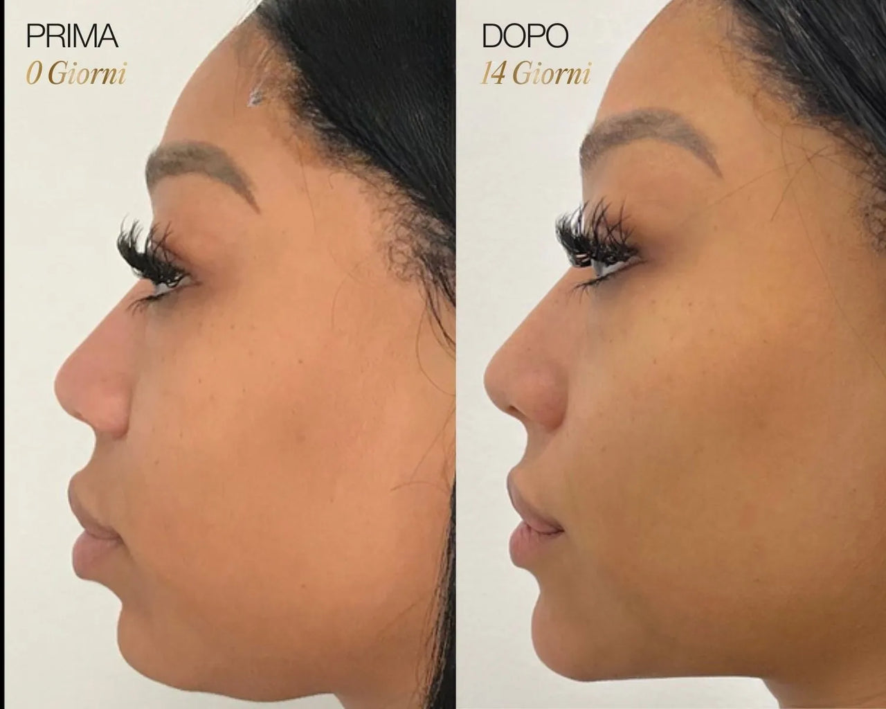 Lymphatic Face Brush iBrushy