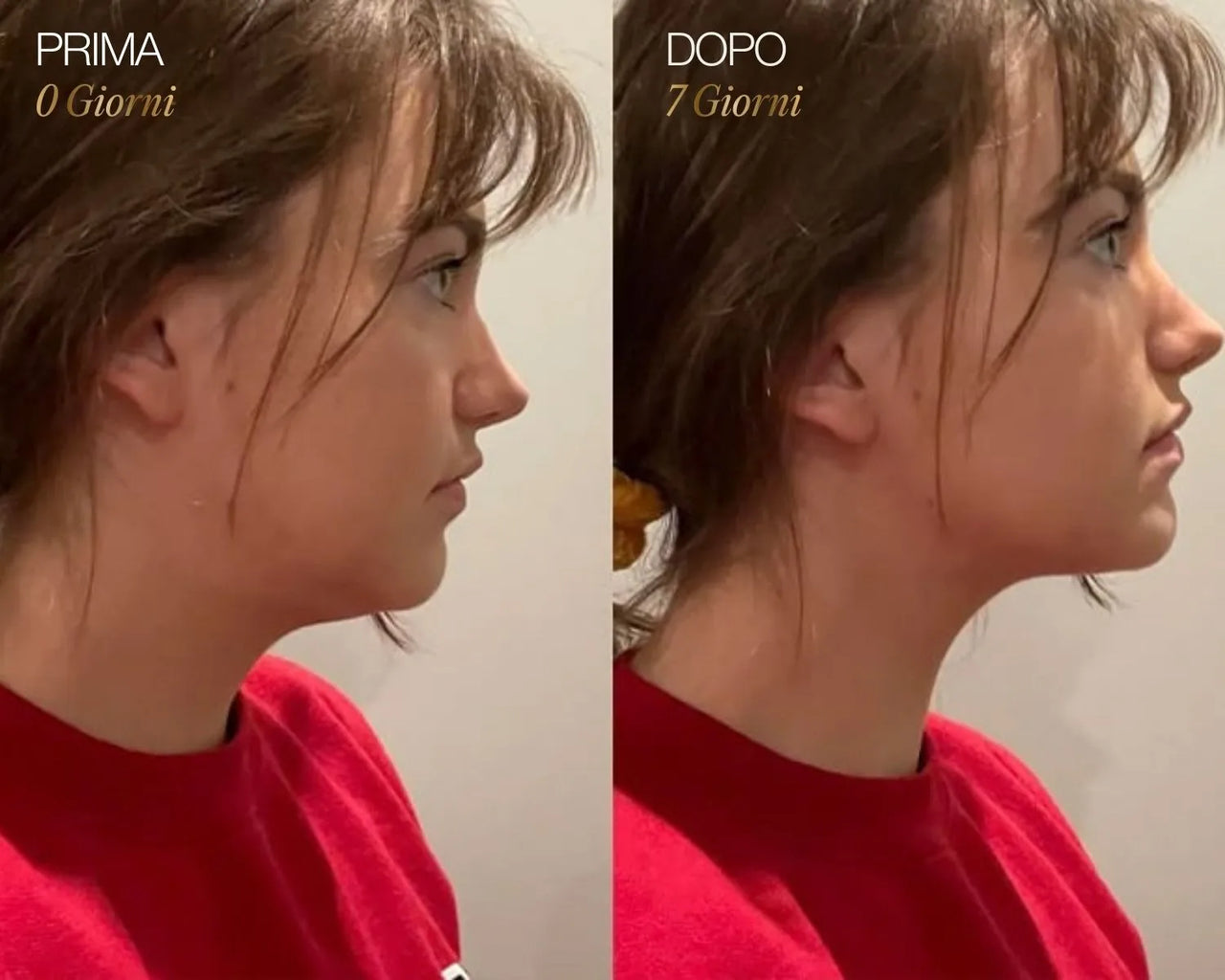 Lymphatic Face Brush iBrushy