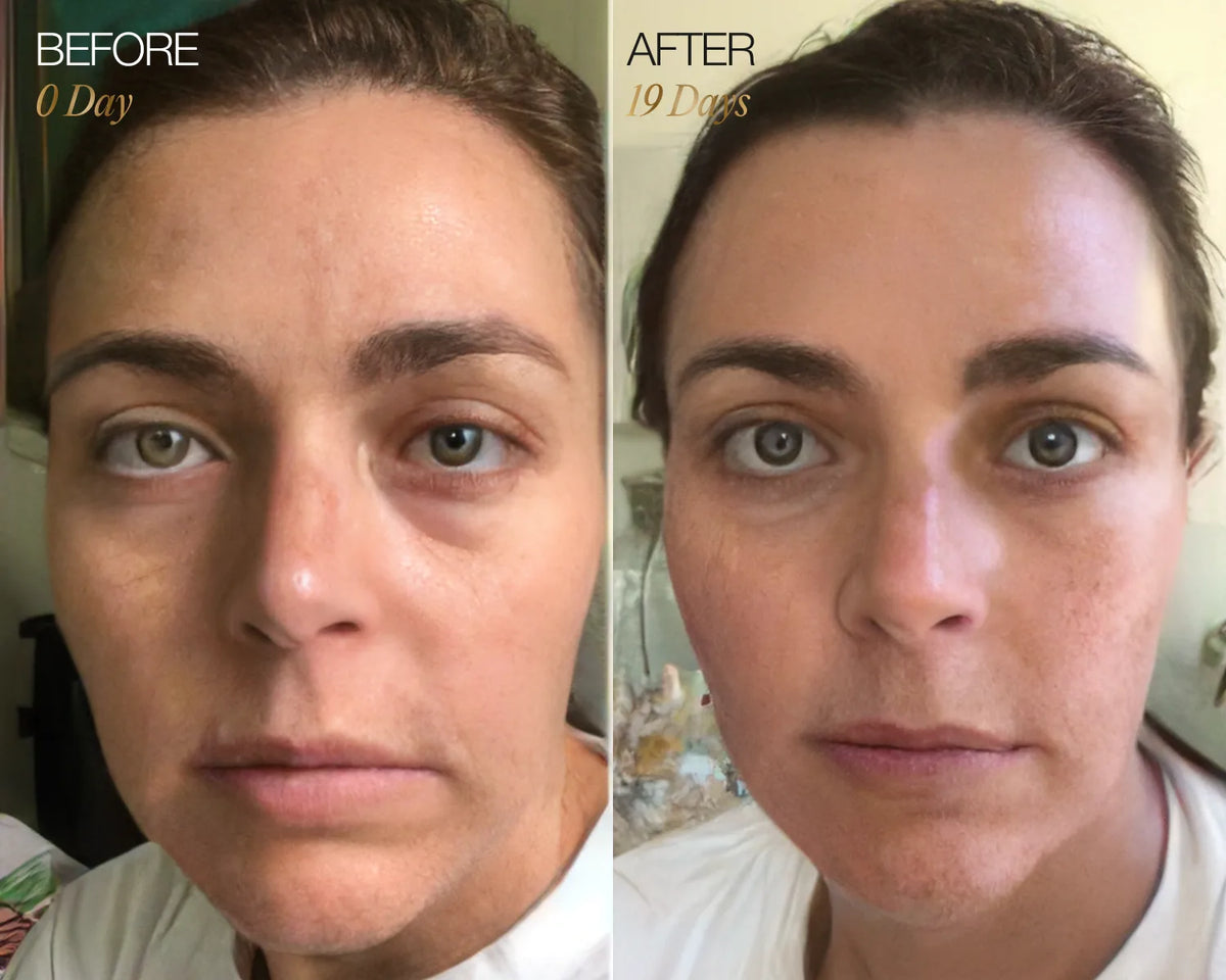 Lymphatic Face Brush