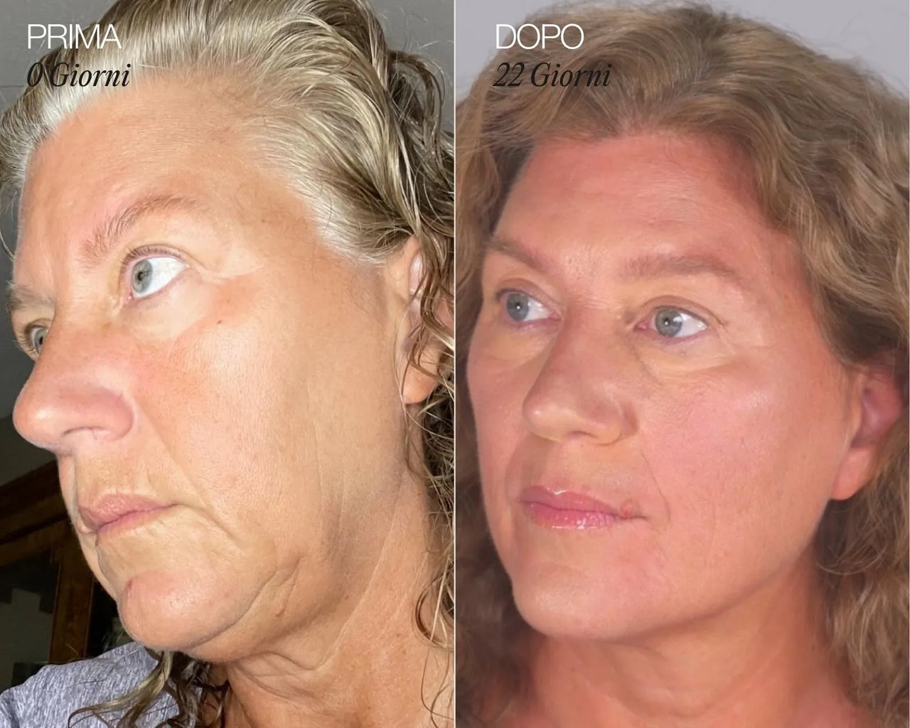 Lymphatic Face Brush iBrushy