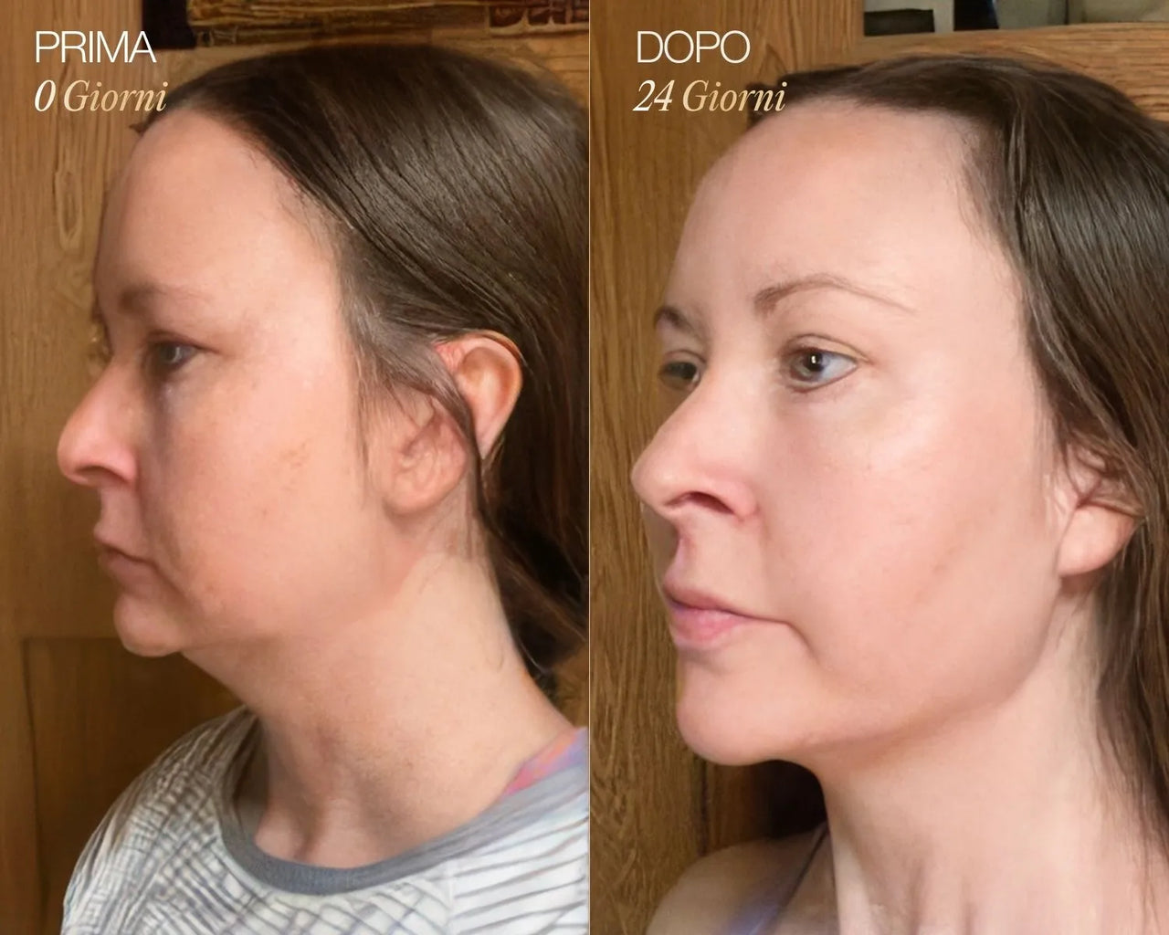 Lymphatic Face Brush iBrushy