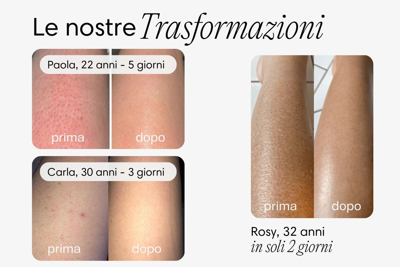 Body Brush iBrushy™